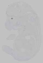 EMAGE:15557