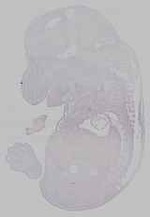 EMAGE:15557