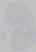 EMAGE:15557