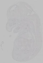 EMAGE:15557
