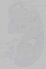 EMAGE:15557