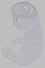 EMAGE:15557