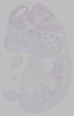 EMAGE:15562