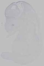 EMAGE:15582