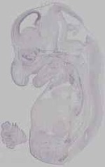EMAGE:15584