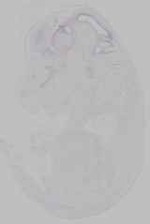EMAGE:15587