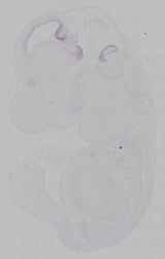 EMAGE:15587