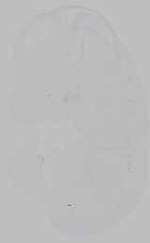EMAGE:15589