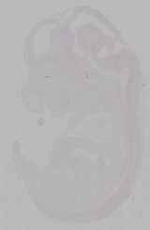 EMAGE:15599