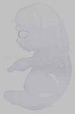 EMAGE:15605