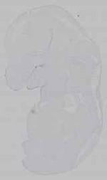 EMAGE:15605