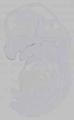EMAGE:15605