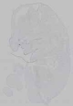 EMAGE:15605
