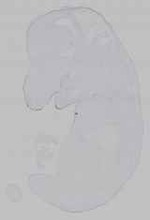 EMAGE:15605