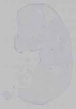EMAGE:15605