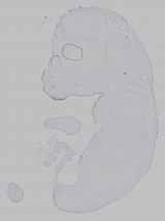 EMAGE:15605
