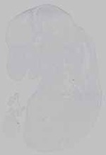 EMAGE:15621