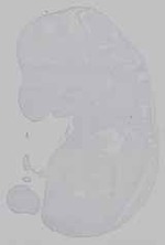 EMAGE:15624