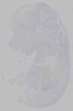 EMAGE:15626