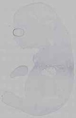 EMAGE:15627