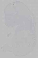 EMAGE:15627