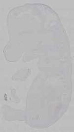 EMAGE:15627