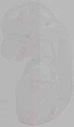 EMAGE:15631
