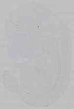 EMAGE:15635