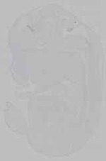 EMAGE:15637