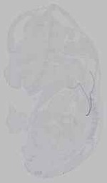 EMAGE:15645