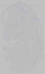 EMAGE:15655