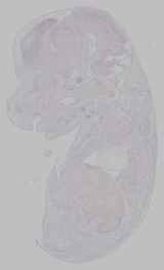 EMAGE:15656