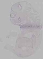 EMAGE:15658