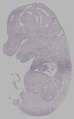 EMAGE:15658