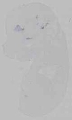 EMAGE:15661