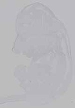EMAGE:15662