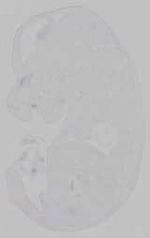 EMAGE:15678