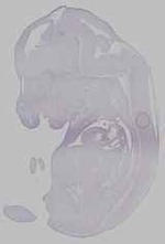 EMAGE:15685