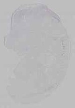 EMAGE:15715