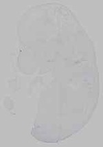 EMAGE:15719