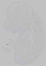 EMAGE:15738