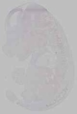 EMAGE:15742