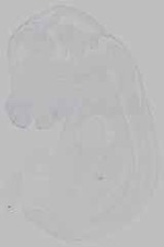 EMAGE:15747