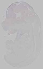 EMAGE:15752
