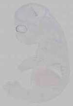 EMAGE:15768