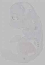 EMAGE:15768