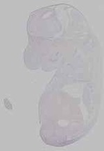 EMAGE:15768