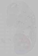 EMAGE:15768