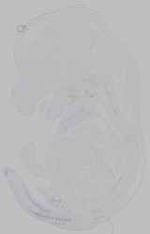 EMAGE:15769