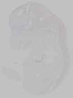 EMAGE:15793